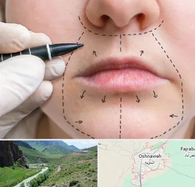 عمل سانترال لب در اشنویه