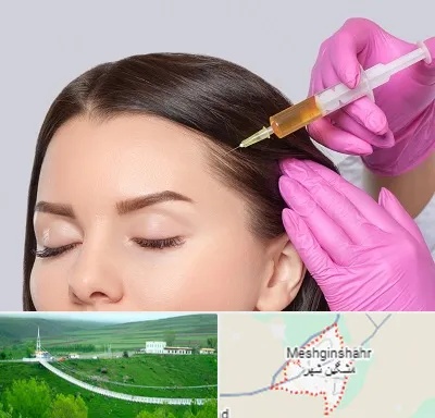 تزریق هیر فیلر در مشگین شهر