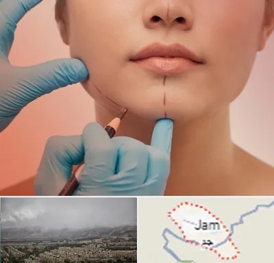 دکتر زیبایی خانم در جم
