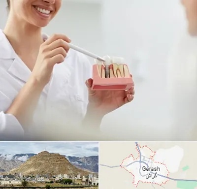 دکتر دندانساز در گراش