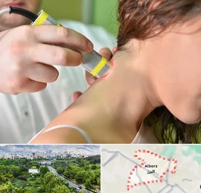 لیزر درمانی در البرز