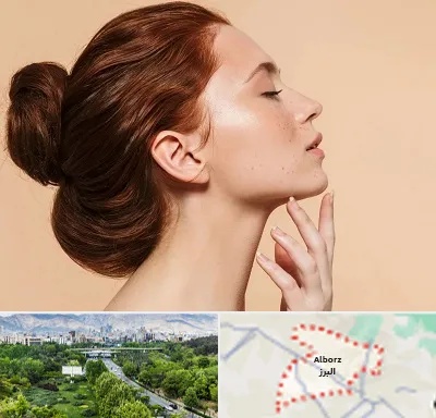 جراحی غبغب در البرز