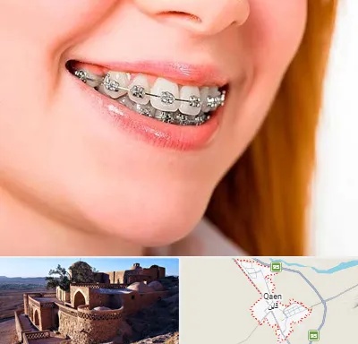 ارتودنسی ارزان در قائن