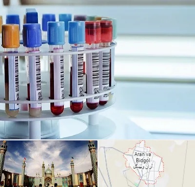 آزمایشگاه ژنتیک در آران و بیدگل