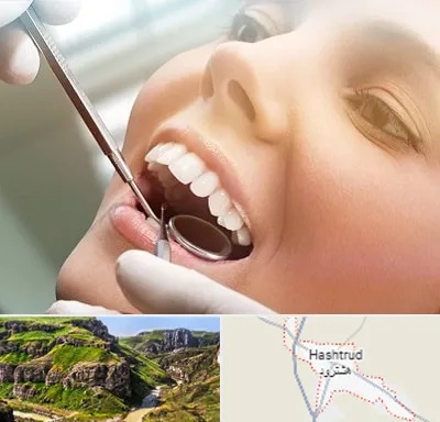 دندانپزشکی زیبایی در هشترود