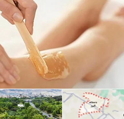 اپیلاسیون بدن در البرز