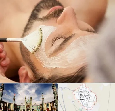 فیشیال صورت آقایان در آران و بیدگل