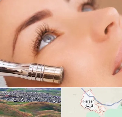 میکرودرم در فارسان