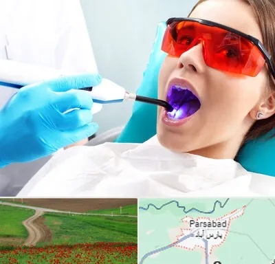 جراحی لثه با لیزر در پارس آباد