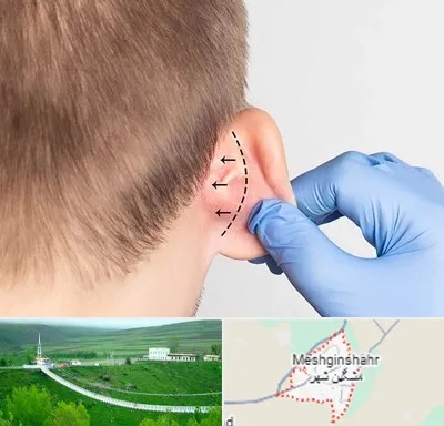 عمل زیبایی گوش در مشگین شهر