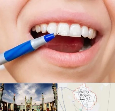 دندانسازی ارزان در آران و بیدگل