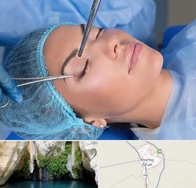 جراحی لیفت ابرو در خورموج