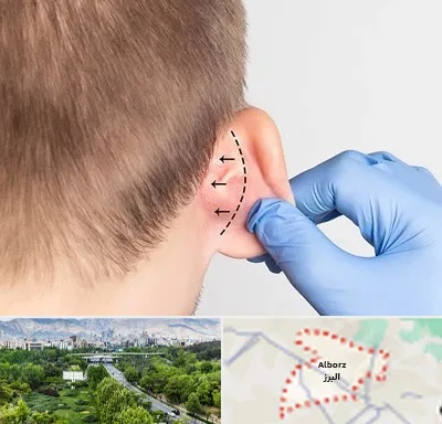 عمل زیبایی گوش در البرز