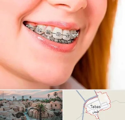 ارتودنسی ارزان در طبس