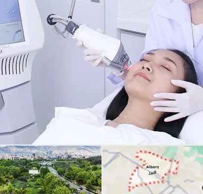 وایتنینگ در البرز