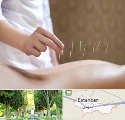 درای نیدلینگ در استهبان