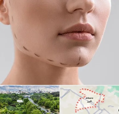 عمل زاویه فک در البرز