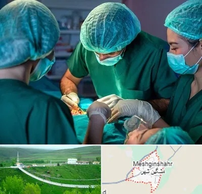 عمل کوچک کردن سینه در مشگین شهر