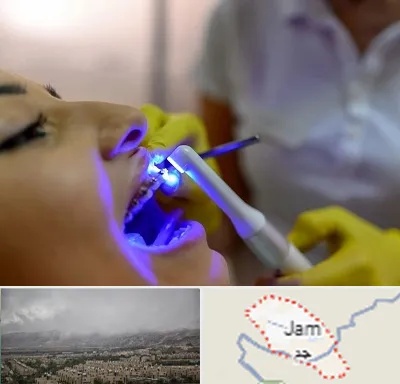 دندانپزشکی با لیزر در جم