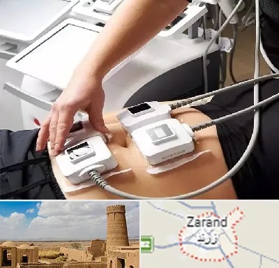 ترواسکالپ در زرند