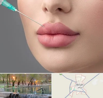 کلینیک ژل لب روسی در بروجن