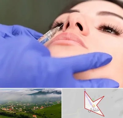 هیالاز در خلخال