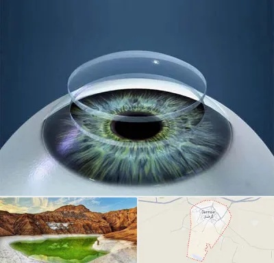 پیوند قرنیه در گرمسار
