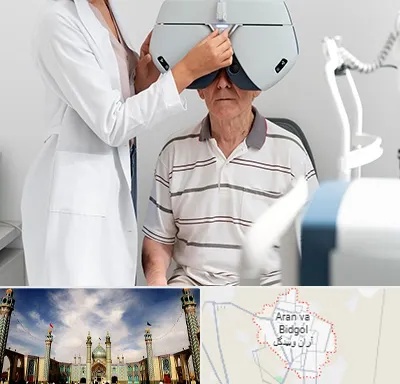 دکتر سرطان چشم در آران و بیدگل