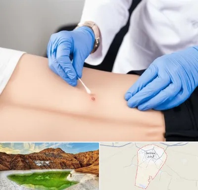 متخصص زخم بستر در گرمسار