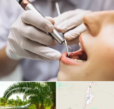 دندانپزشکی ارزان در کهنوج