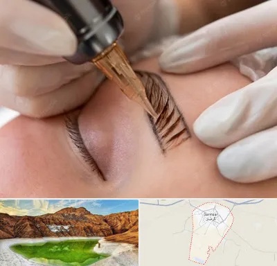 میکروبلیدینگ در گرمسار