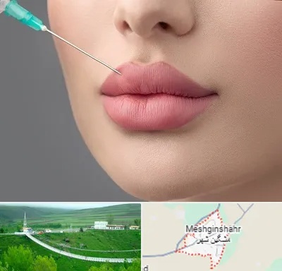 کلینیک ژل لب روسی در مشگین شهر