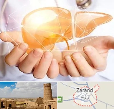 دکتر سرطان کبد در زرند