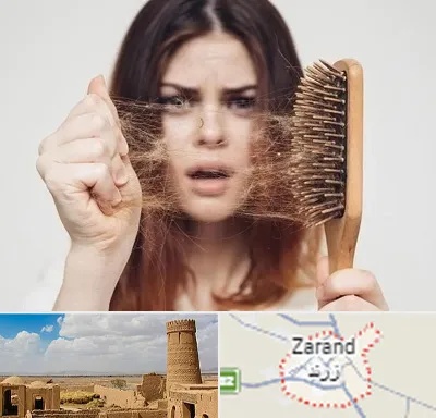دکتر ریزش مو در زرند