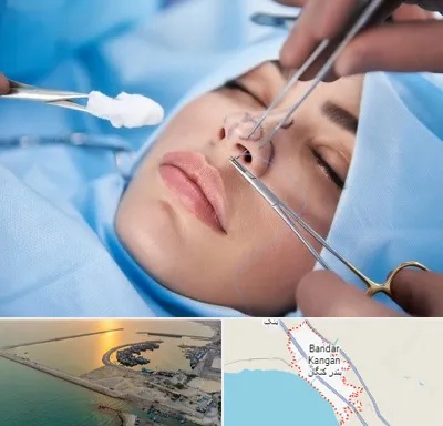 عمل ترمیمی بینی در بندر کنگان