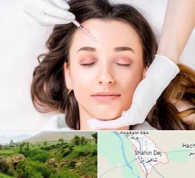 مزوتراپی ابرو در شاهین دژ
