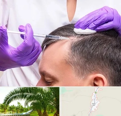 دکتر فوق تخصص پوست و مو در کهنوج
