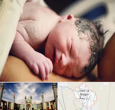 زایمان فیزیولوژیک در آران و بیدگل
