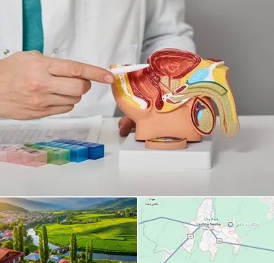 دکتر اورولوژی در لشت نشا