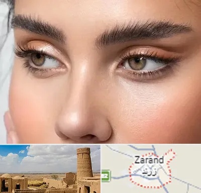 کانتو پلاستی در زرند