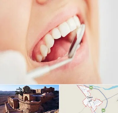 اصلاح طرح لبخند در قائن