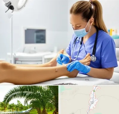 کارشناس زخم در کهنوج