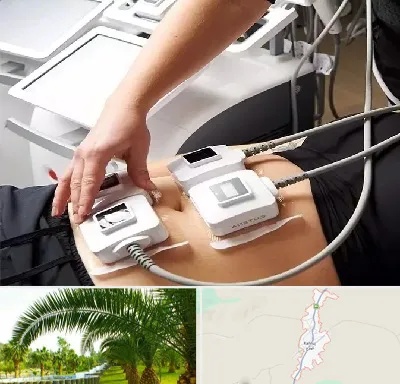 ترواسکالپ در کهنوج