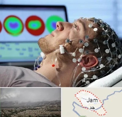 مرکز نوار مغز در جم