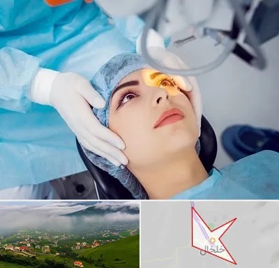 دکتر عمل لیزیک چشم در خلخال