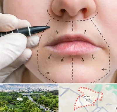 عمل سانترال لب در البرز