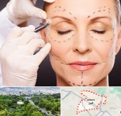دکتر زیبایی صورت در البرز