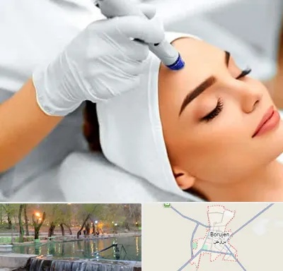 آموزش مزوتراپی در بروجن