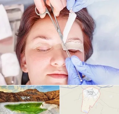 جراحی پلک افتاده در گرمسار