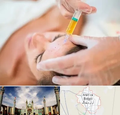 پی آر پی در آران و بیدگل